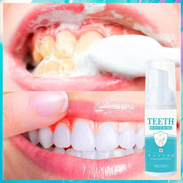 🎄 EARLY CHRISTMAS SALE 60% OFF🎁 TEETH WHITENING MOUSSE