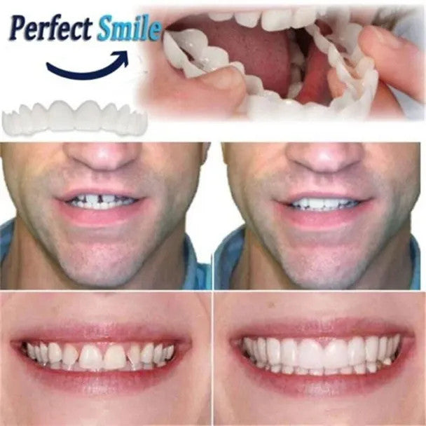Last day discount-(50%Off)- Adjustable dentures